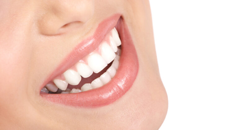Teeth Whitening Near Me – Which Teeth Whitening Method is Best For You?